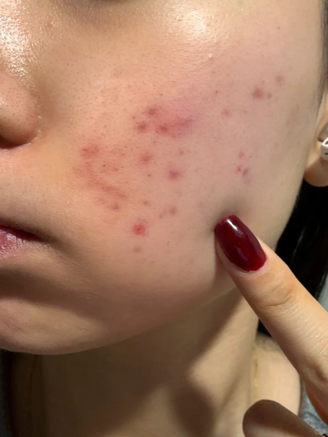 没换了？这种毛巾建议马上换掉冰球突破平台你家的毛巾多久(图5)