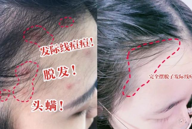 干好？10分钟轻松养成女明星「绸缎发」冰球突破游戏网站洗完头自然风干还是吹(图10)